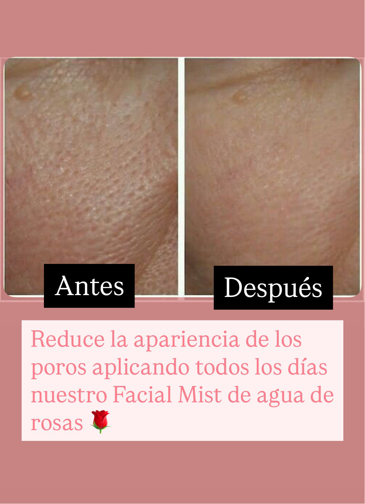 Rose Water-Refreshing Facial Mist